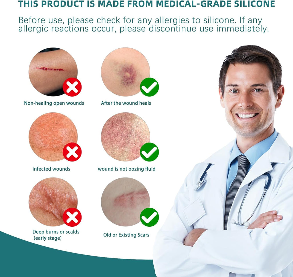 Silicone Scar Tape for Surgical Scars: Medical Grade Scar Gel Sheets for C-Section Tummy Tuck Recovery and Treatment – Reusable Scar Strips for Keloid Burn Acne Scars Removal (1.6'' x 60''Roll-1.5M)