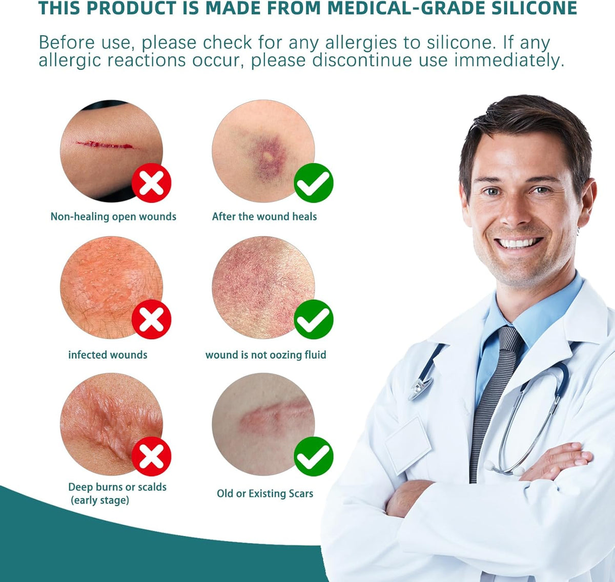 Silicone Scar Tape for Surgical Scars: Medical Grade Scar Gel Sheets for C-Section Tummy Tuck Recovery and Treatment – Reusable Scar Strips for Keloid Burn Acne Scars Removal (1.6'' x 60''Roll-1.5M)