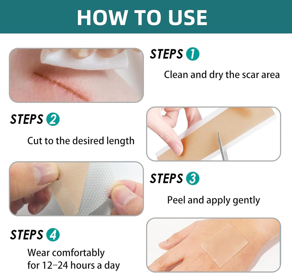 Silicone Scar Tape for Surgical Scars: Medical Grade Scar Gel Sheets for C-Section Tummy Tuck Recovery and Treatment – Reusable Scar Strips for Keloid Burn Acne Scars Removal (1.6'' x 60''Roll-1.5M)