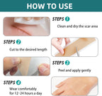 Silicone Scar Tape for Surgical Scars: Medical Grade Scar Gel Sheets for C-Section Tummy Tuck Recovery and Treatment – Reusable Scar Strips for Keloid Burn Acne Scars Removal (1.6'' x 60''Roll-1.5M)