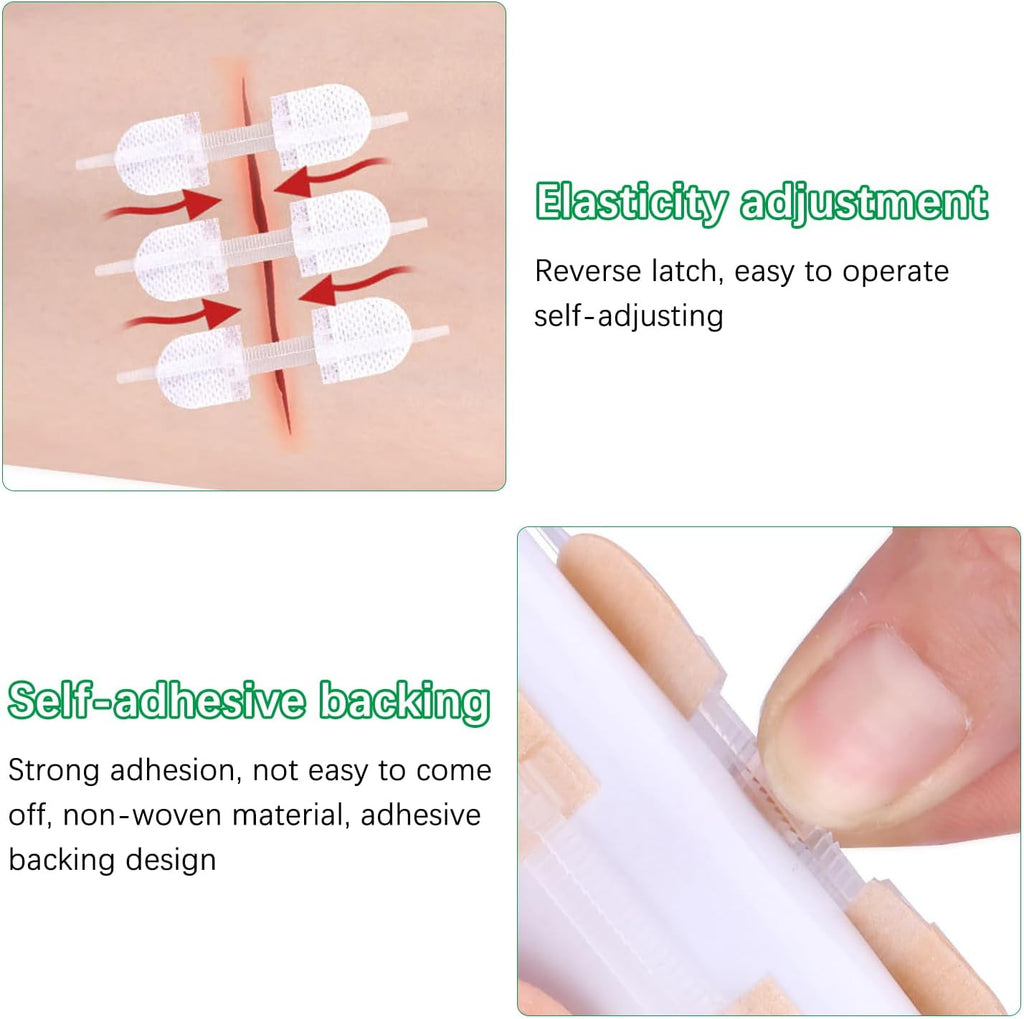 12 Pieces Wound Closure Strips, Adhesive Suture Dots, Healing Plasters, Wound Care, First Aid Adhesive Bandage, Home and Outdoor Products