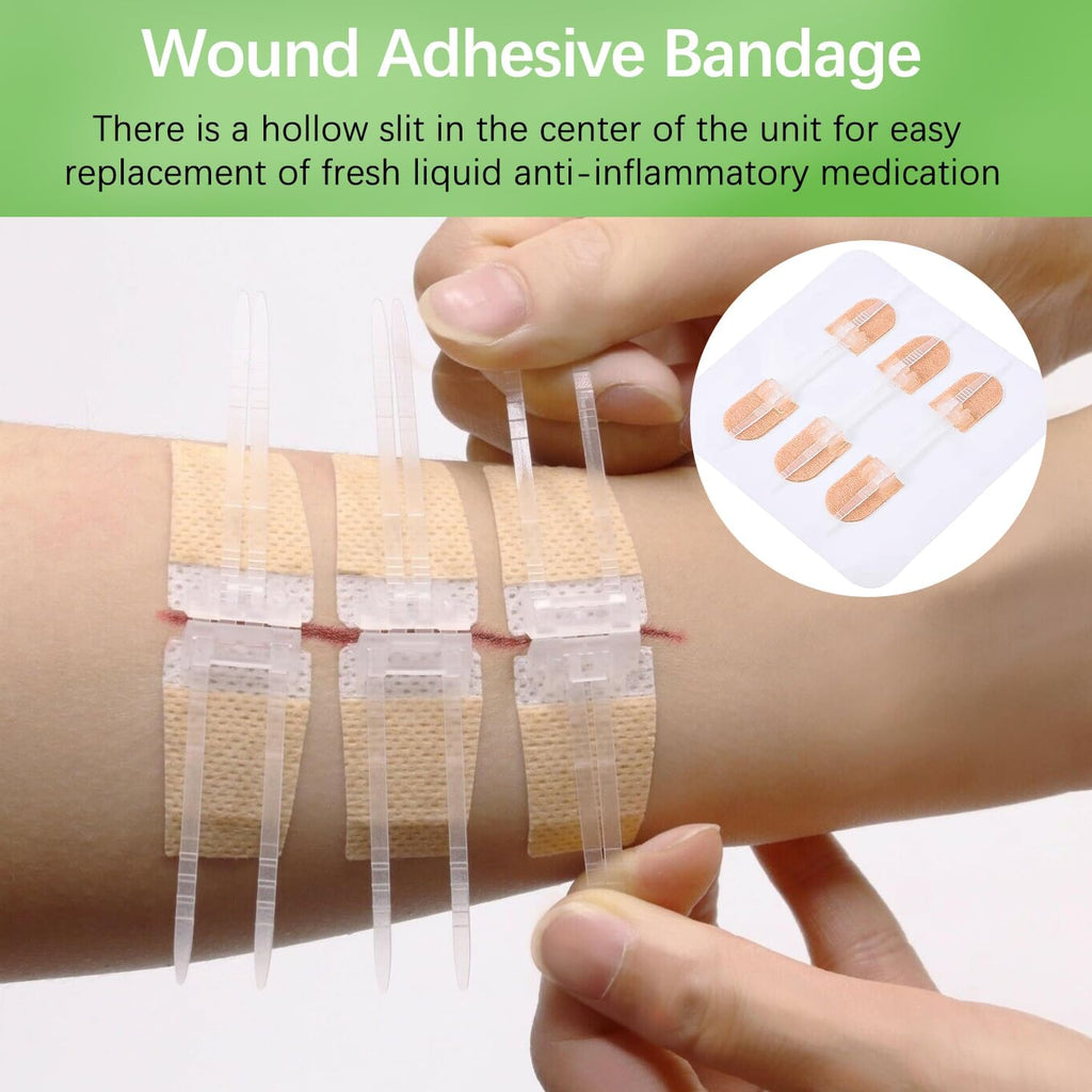 12 Pieces Wound Closure Strips, Adhesive Suture Dots, Healing Plasters, Wound Care, First Aid Adhesive Bandage, Home and Outdoor Products
