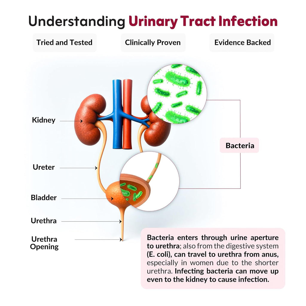 UT Health | UTI Prevention & Urinary Tract Support | With Cranberry Extract, D-Mannose, Hibiscus & 2 Probiotics | Helps Reduce Burning & Pain | Cranberry Flavour, 30 x 2g Powder Sachets