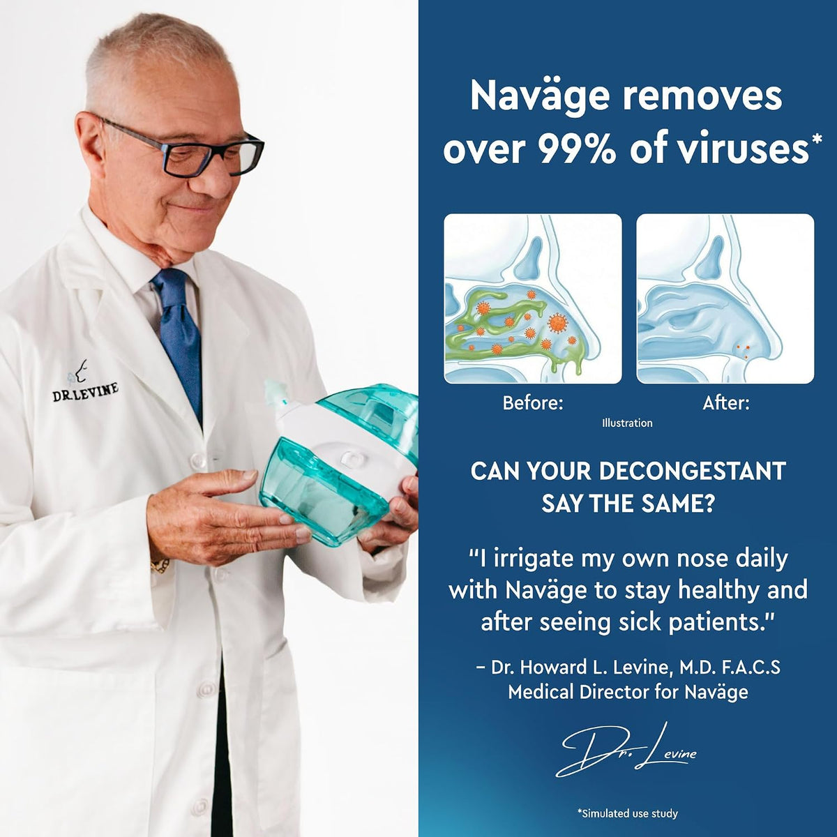 NAVAGE® Deluxe Bundle: Nose Cleaner, 30 SaltPods, Caddy, Black Bag | Deluxe Set: Powered Nose Sinus Cleaner, Storage Caddy, Batteries & Matching Black Travel Bag for Congestion & Sinus Relief