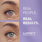 Lumify Redness Relief Eye Drops, Whiter & Brighter Looking Eyes, 0.17 oz | Fast-acting redness relief in 1 min, lasts up to 8 hours, For Whiter & Brighter Looking Eyes, 5 mL