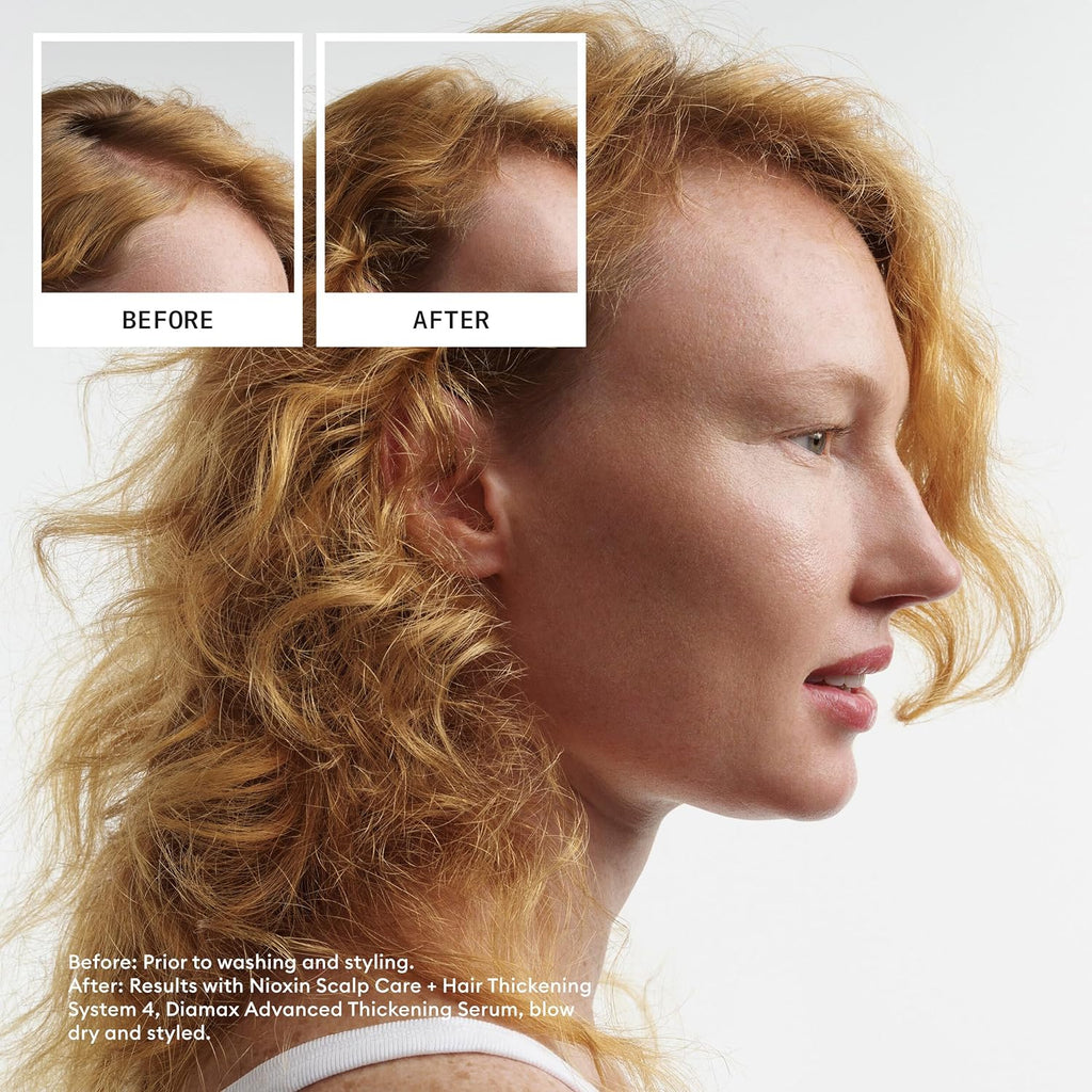 NIOXIN System Kits | Scalp + Hair Thickening | 1 Month Supply | Natural, Colored & Damaged Hair with Light to Progressed Thinning | Strengthen & Boost Hair Density with Niacinamide & Biotin