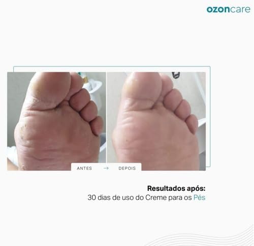 Philozon Skin Care 60g