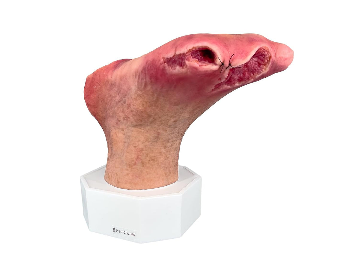 Sockelmodell Wound Care Supplies