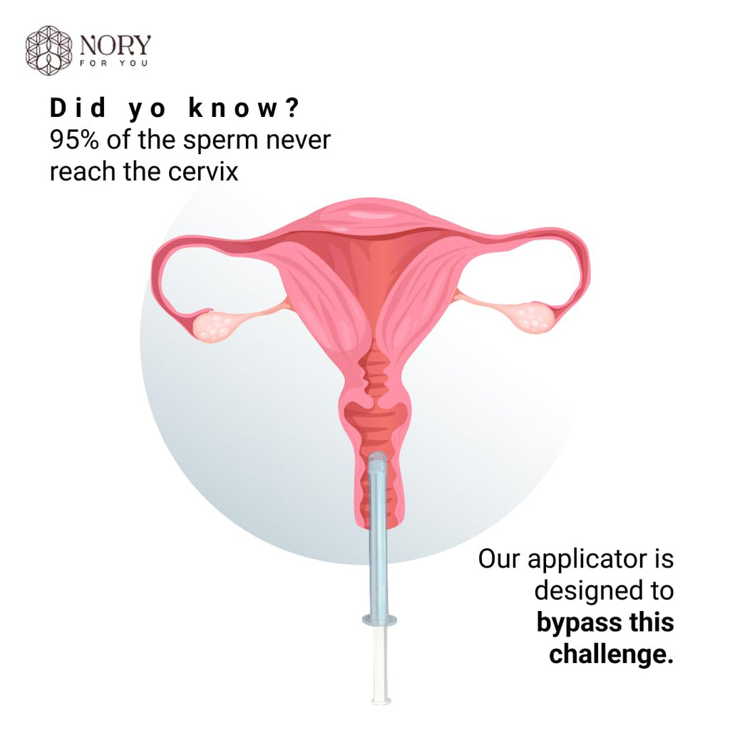 Nory At Home Self Insemination IVI Kit for Women, Designed By Fertility Doctor, Get Pregnant Naturally, Pack of 5 Syringes and1 Reusable Collection Cup with Instruction Manual