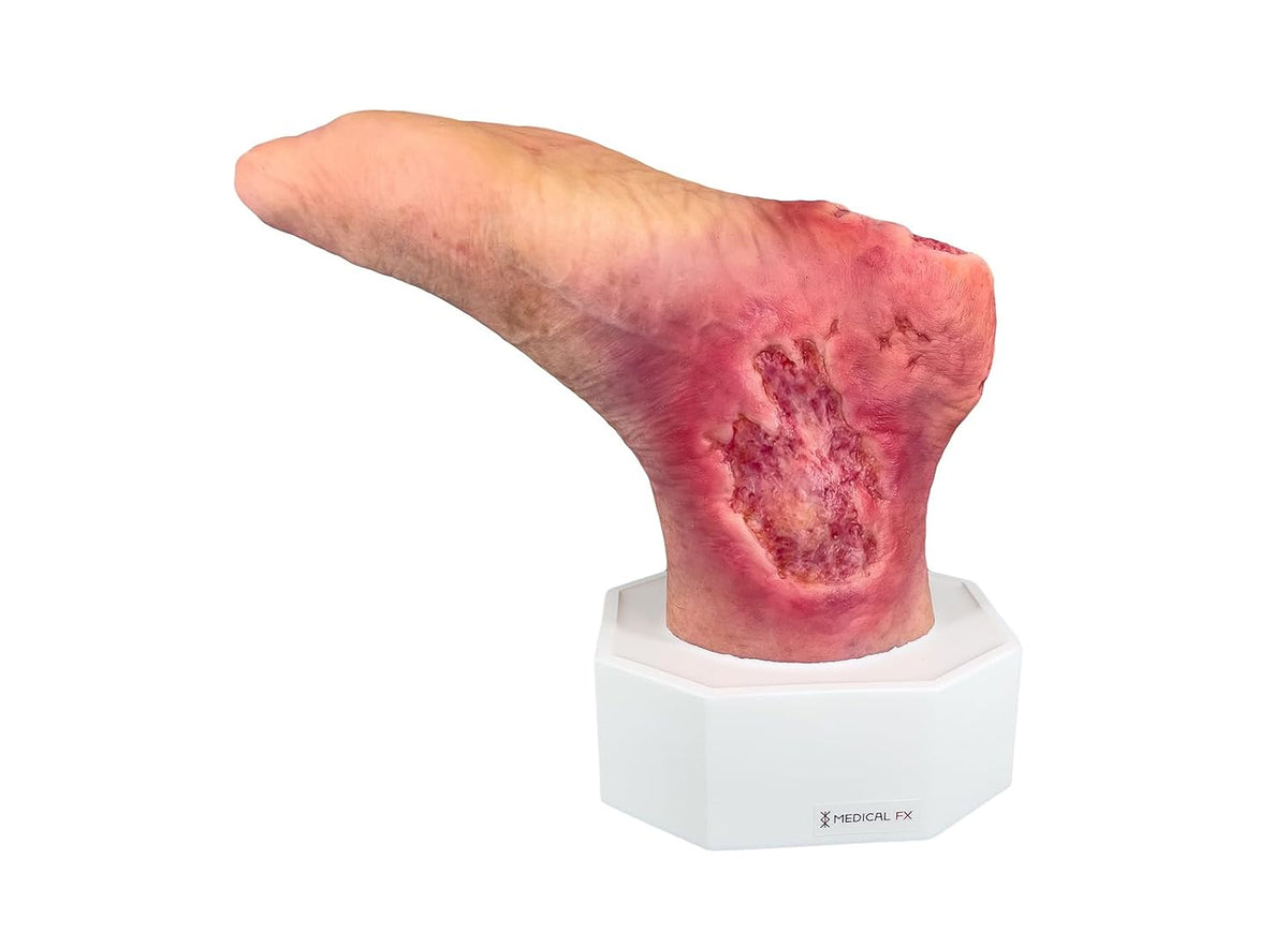 Sockelmodell Wound Care Supplies