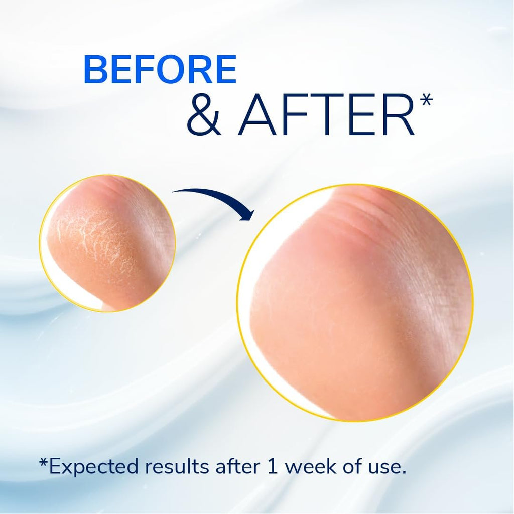 Dr. Scholl's Severe Cracked Heel Repair Restoring Balm 2.5oz, with 25% Urea for Dry, Cracked Feet, Heals and Moisturizes for Healthy Feet