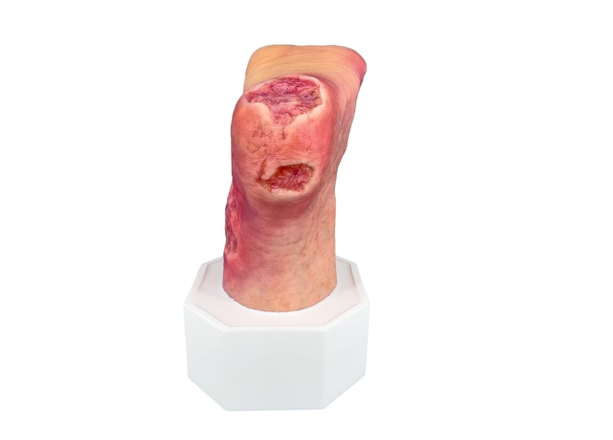 Sockelmodell Wound Care Supplies