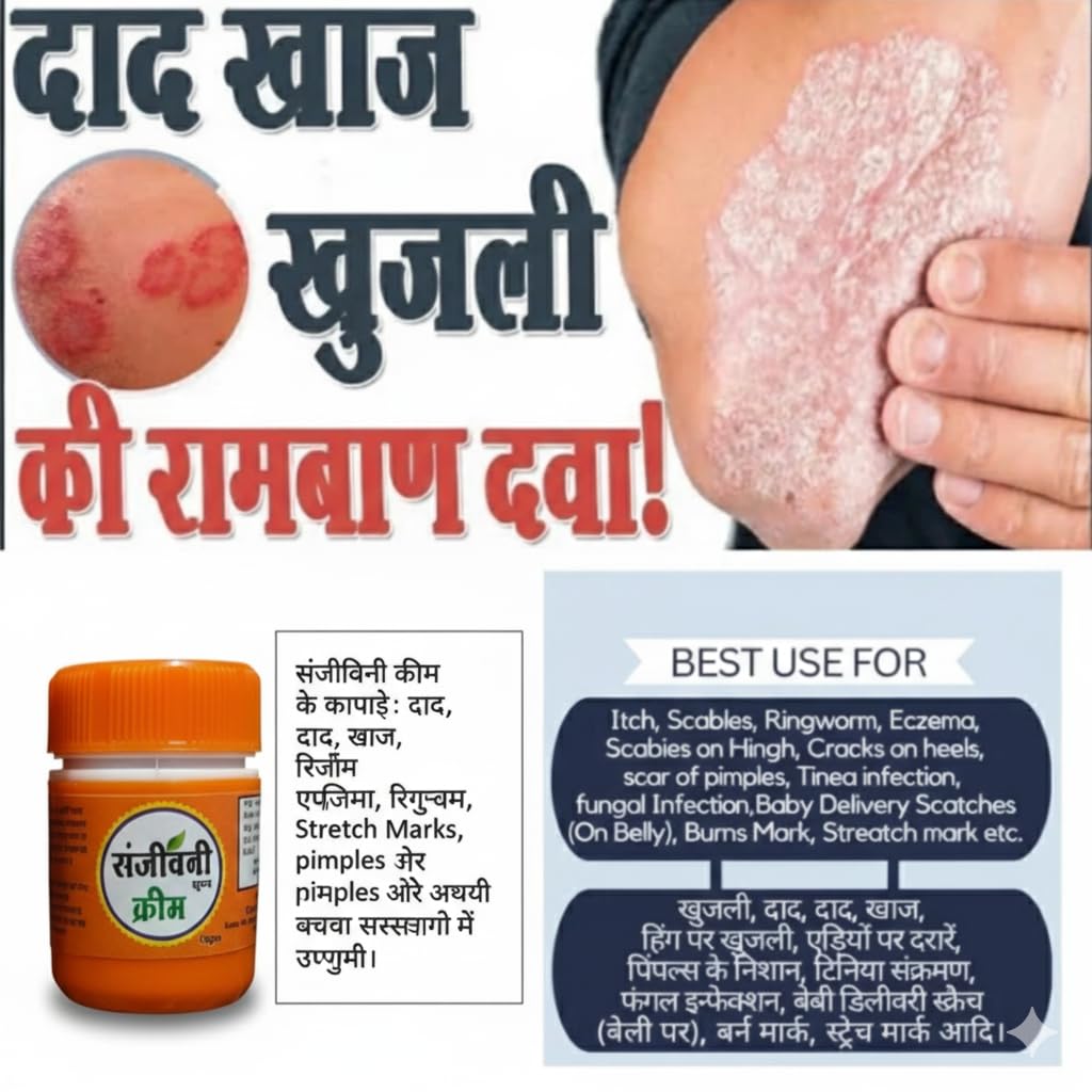 Super Eczema Fungal Cream For Men & Women Ayurvedic ItchCoat Anti Fungal Malam For Ringworm itching Eczema (Sanjivanii Fungal Cream, 15gm pack of 2)