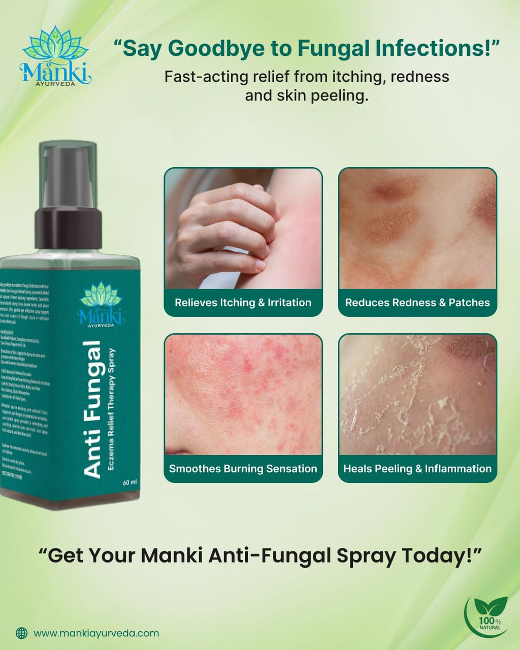 Herbal Anti Fungal Spray | Skin Care Spray for Itching, Odour & Irritation | Natural Ingredients | Suitable for Feet, Underarms & Body | 60ml