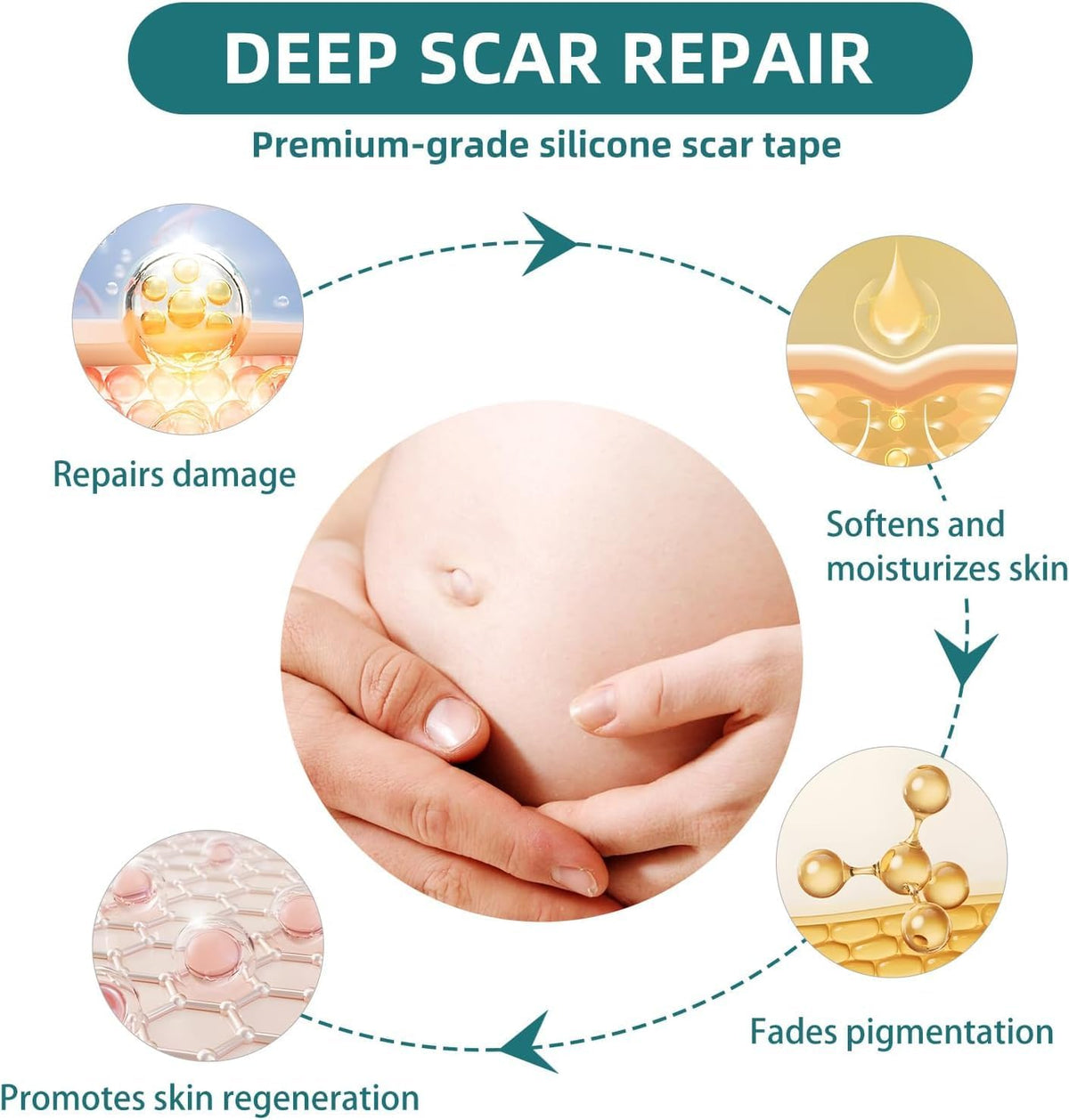 Silicone Scar Tape for Surgical Scars: 3 Meters Scar Gel Sheets for C-Section Tummy Tuck Recovery and Treatment – Reusable Scar Strips for Keloid Burn Scars Removal (1.6'' x 120'' Roll-3M)