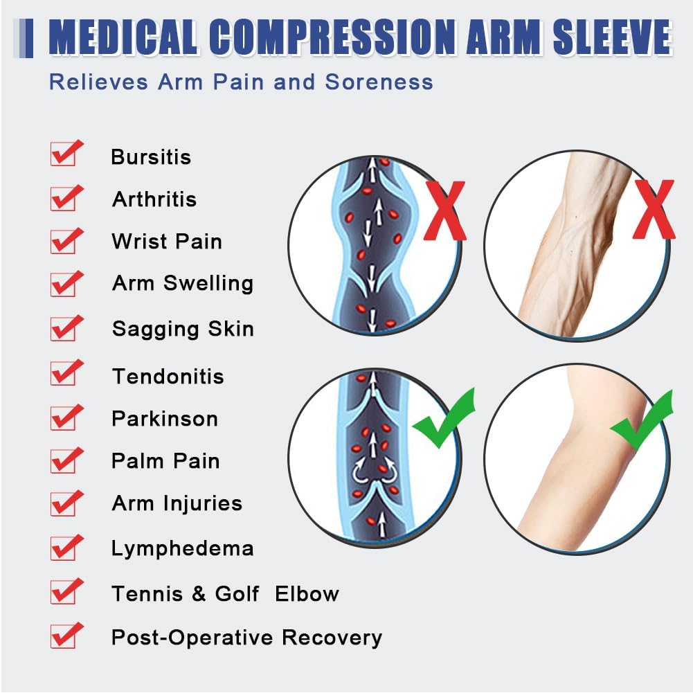 beister Lymphedema Medical Compression Arm Sleeve with Gauntlet for Men & Women (Single), 20-30 mmHg Full Arm Support.