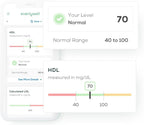Everlywell At-Home Cholesterol and Lipids Lab Test Collection Kit for Women and Men, Measures HDL, LDL and Triglycerides for Accurate Results from a CLIA-Certified Lab Within Days, for Ages 18 Plus