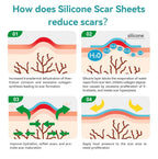 Dimora Medical Grade Silicone Scar Sheets, 1.6"x120" Roll