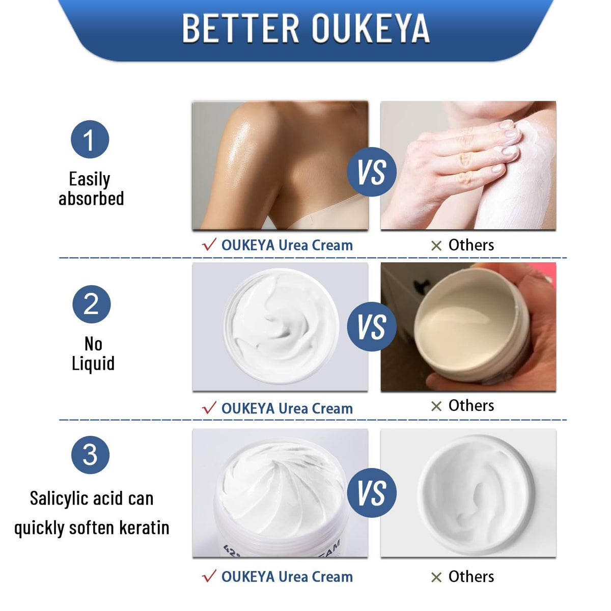 OUKEYA Urea Cream 42% to Soften & Smooth Dry, Cracked, Rough Skin | Urea Foot Cream, 2% Salicylic Acid, Exfoliating, Moisturizing Lotion, Hand, Heels, Elbows, Knees, 5.29oz