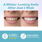 Venus Visage Teeth Whitening Pen and Tooth Polishing Kit (Pack of 2) – Professional Teeth Whitening Gel, 30+ Uses, Low Sensitivity, Enamel-Safe Mint Formula – Removes Coffee, Wine & Tobacco Stains