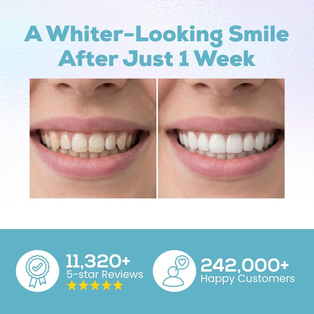 Venus Visage Teeth Whitening Pen and Tooth Polishing Kit (Pack of 2) – Professional Teeth Whitening Gel, 30+ Uses, Low Sensitivity, Enamel-Safe Mint Formula – Removes Coffee, Wine & Tobacco Stains