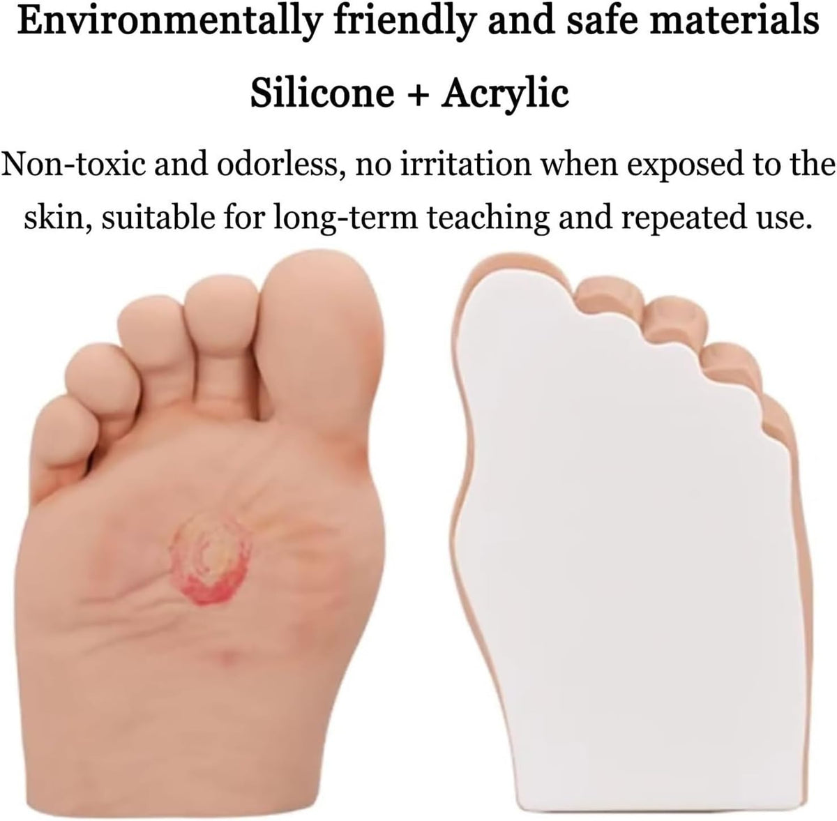Diabetiker Wound Dressings and Gauze