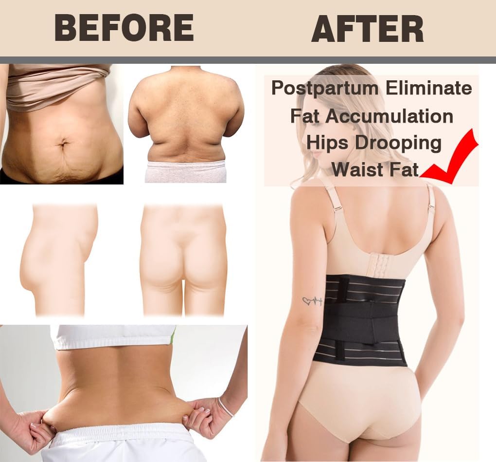 Vivva Belly Band Recovery Support Belt Wrap- Post Partum Girdles Tummy Bandit Binder - Postnatal Abdomen Pelvic Compression Corset Binding Body Shaper Shapewear