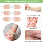 6 Pieces Wound Closure Strips, Adhesive Suture Dots, Wound Care, Wound Care Adhesive Bandage, First Aid Bandage, Home and Outdoor Products