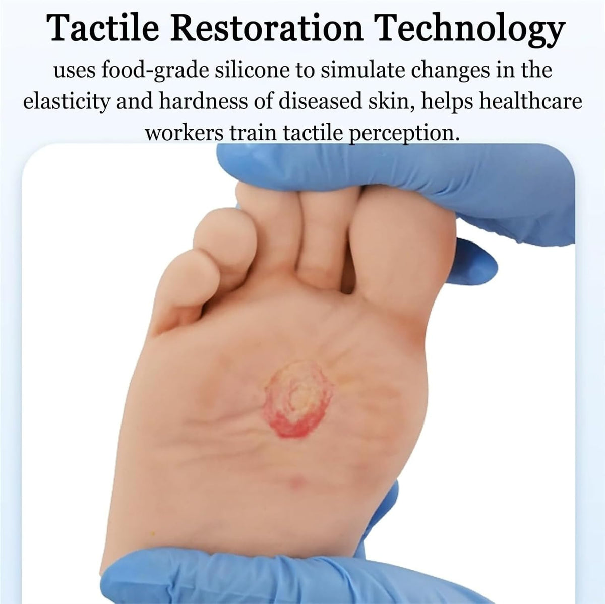 Diabetiker Wound Dressings and Gauze