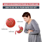 99% Accurate H. Pylori Test Kit (5 Pcs) – At-Home Rapid Self Test Card for Gut Health, Detects H Pylori & Stomach Infections, Professional Grade Test Paper for Quick Results.