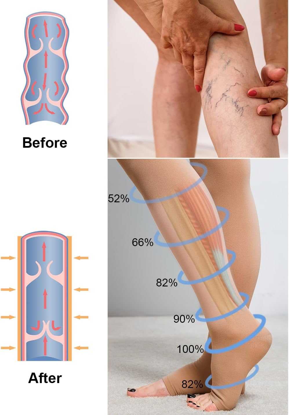 Compression Socks 30 mm