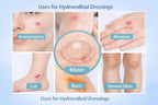 Medical-Grade Hydrocolloid Roll for Wound Care – 5cm x 2m Pimple Patch Roll, Hydrocolloid Bandages, Cut-to-Size Self-Adhesive Patch, Waterproof & Ultra-Absorbent Dressing Tape for Acne & Blisters