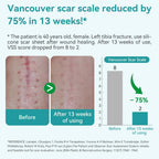 Dimora Medical Grade Silicone Scar Sheets, 1.6"x120" Roll