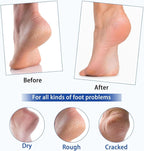 Urea Cream 40%, Keratolytic Foot Cream for Dry Cracked Heels, Feet, Knees, Elbows, Hands, Cuticle, Callus Remover, Skin Barrier Repair