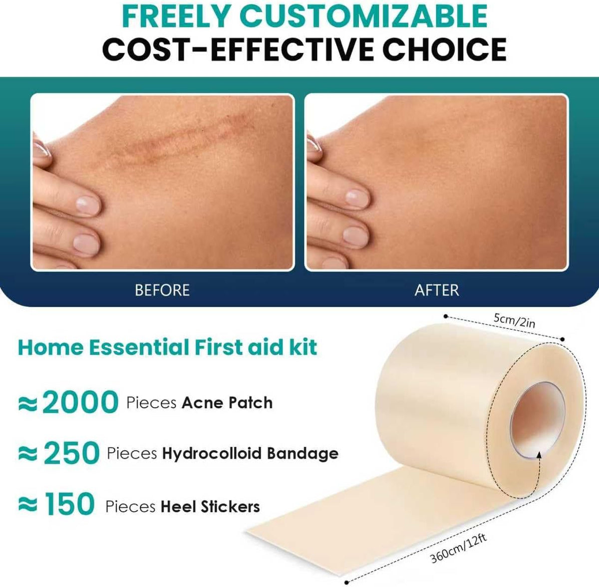 Medical-Grade Hydrocolloid Roll for Wound Care: 5cm × 3.6m Hydrocolloid Bandages, Cut-to-Size Self-Adhesive Patch Dressing, Waterproof & Ultra Absorbent Tape for Burns, Blisters, Acne, First Aid Kit