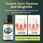 OraMD 4-in-1 Original Tooth Oil - Gum Disease Gingivitis Treatment (1 Pack) | Clinically Tested, Periodontal Disease Treatment, Sensitive Teeth & Gums, Chemical-Free Solution, 250,000+Satisfied Customers