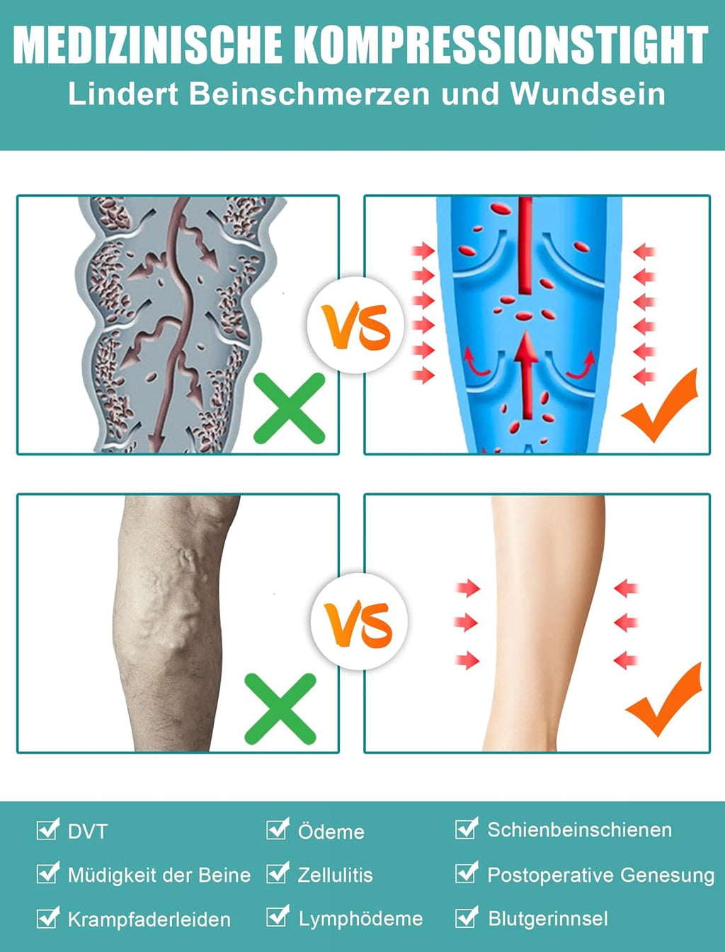 Compression Socks 20 mm
