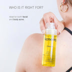 ACNEMY ZITBACK® Anti-Acne Body Spray with AHA and Lemon Water, 80 ml – Removes Blackheads on Back and Body, Quick Drying, Oil-Free, Reduces Imperfections