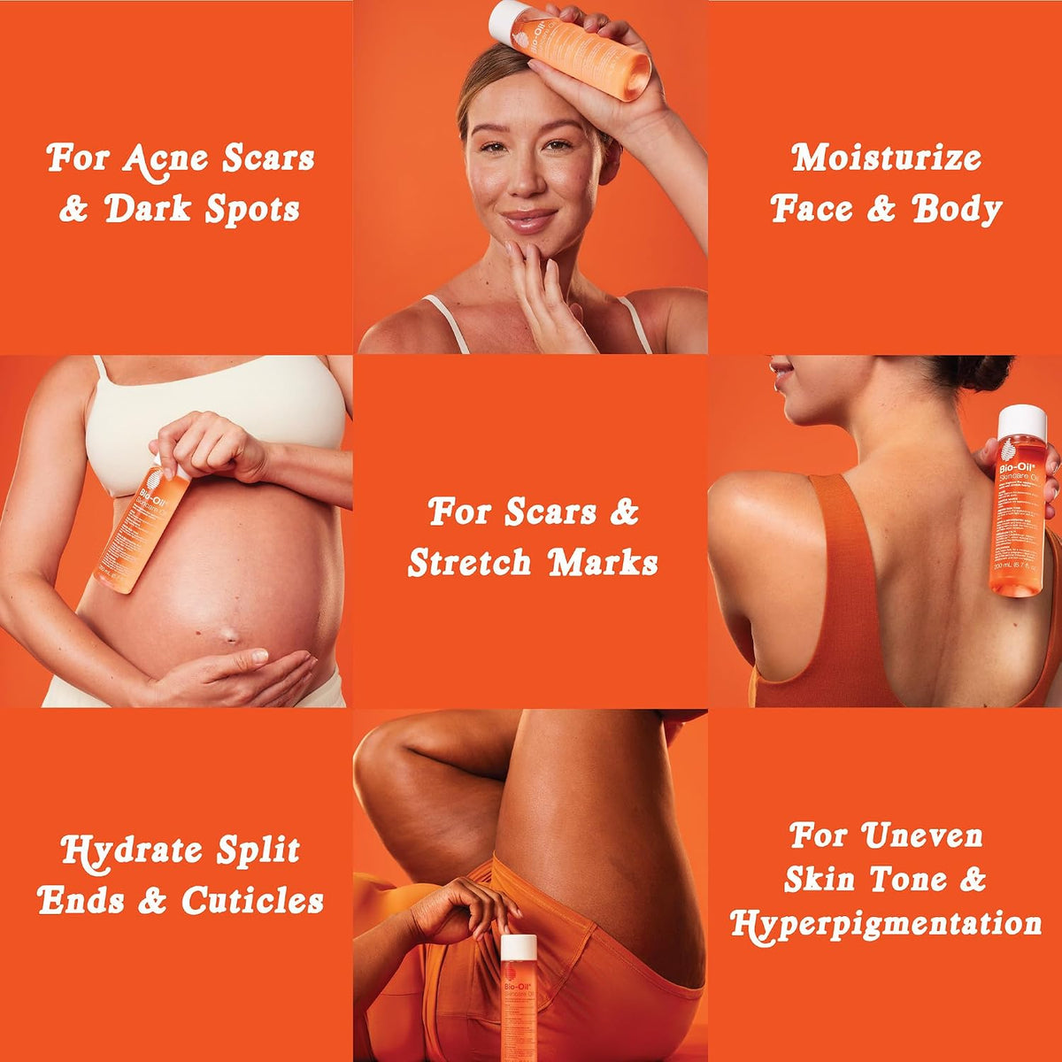 Bio-Oil Skincare Body Oil Serum for Scars and Stretch Marks, Face and Body Moisturizer with Vitamin E & A for Sensitive Dry Skin, Dermatologist Recommended, Non-Comedogenic, 2 oz, Case of 24