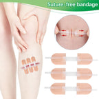 6 Pieces Wound Closure Strips, Adhesive Suture Dots, Wound Care, Wound Care Adhesive Bandage, First Aid Bandage, Home and Outdoor Products