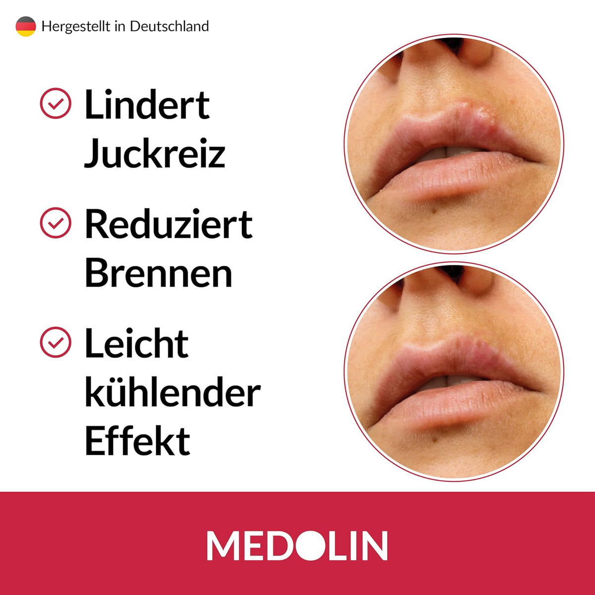 Medolin Skin Care 8 ml