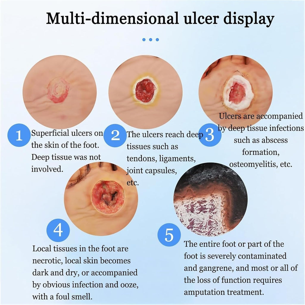 Diabetiker Wound Dressings and Gauze