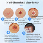 Diabetiker Wound Dressings and Gauze