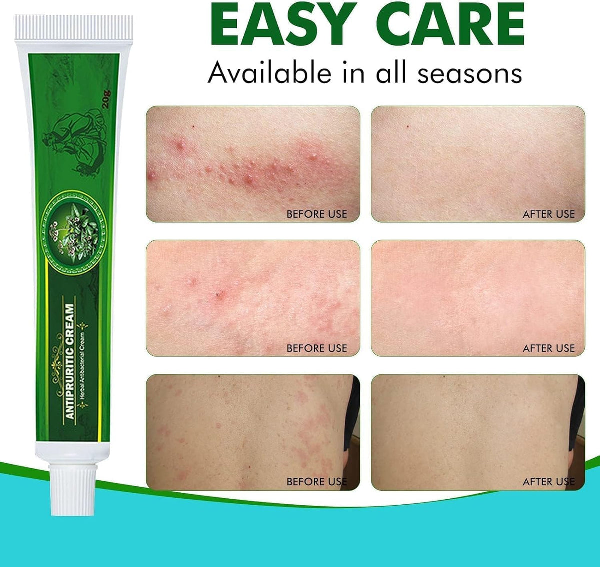 Antifungal Treatments