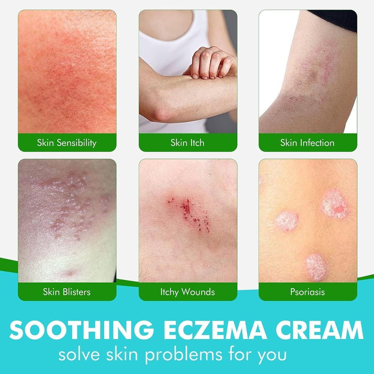 Antifungal Treatments
