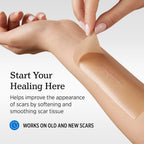 NUVADERMIS Silicone Scar Sheets for Surgical Scars - 120" x 1.5" Roll - Medical Grade Silicone Scar Tape and Face Tape for Wrinkles, Keloid Scars, and Hypertrophic Scars - Reusable - 1 Pack