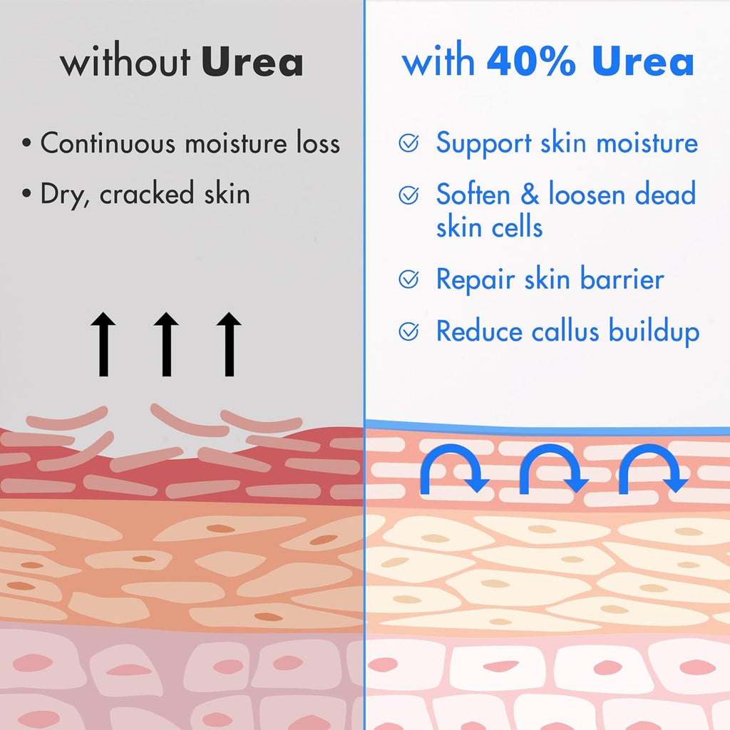 Ebanel Urea Cream 40% plus Salicylic Acid 2% for Dry Cracked Feet Skin, 2PK | Deeply Moisturizes & Softens Dry Cracked Heels, Feet, Knees, Elbows, Hands, Rough Dead Skin Callus Remover Toenail Softener