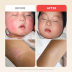 ATOPALM MLE Eczema Cream, 2.2 fl oz (65ml) | calming cream