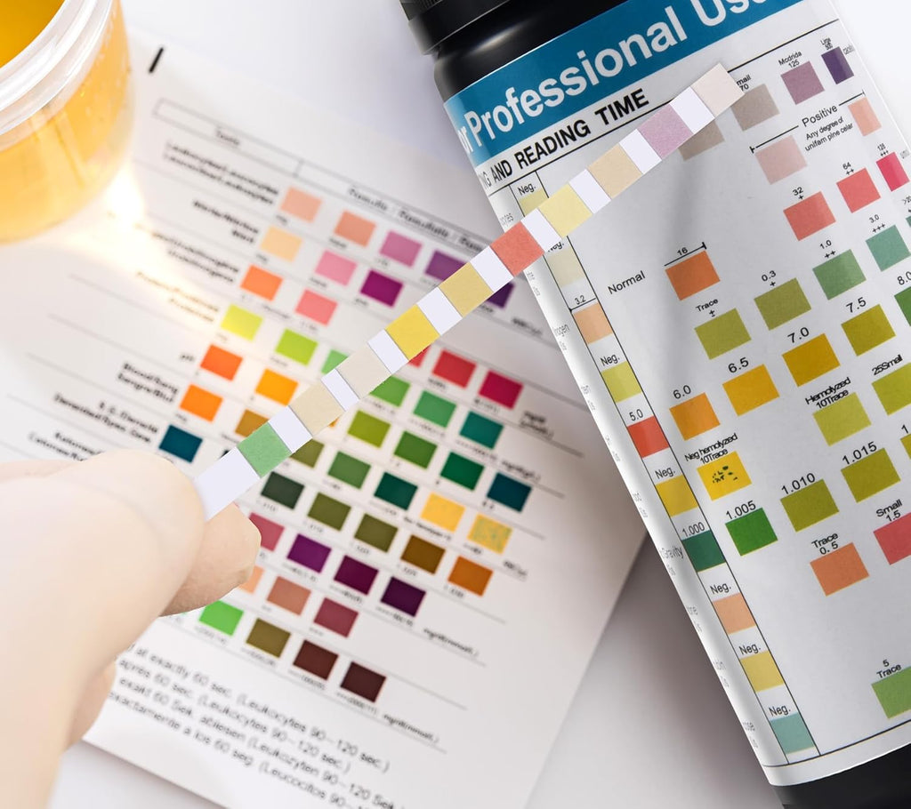 Urinalysis Test Strips, Urine Test Strips, 10 Parameter Urine Strips, Accurate Results, Urinalysis Home Testing Stick Kit to Help Monitor Your Health, Urine Strips DipstickTests - 100 Strips
