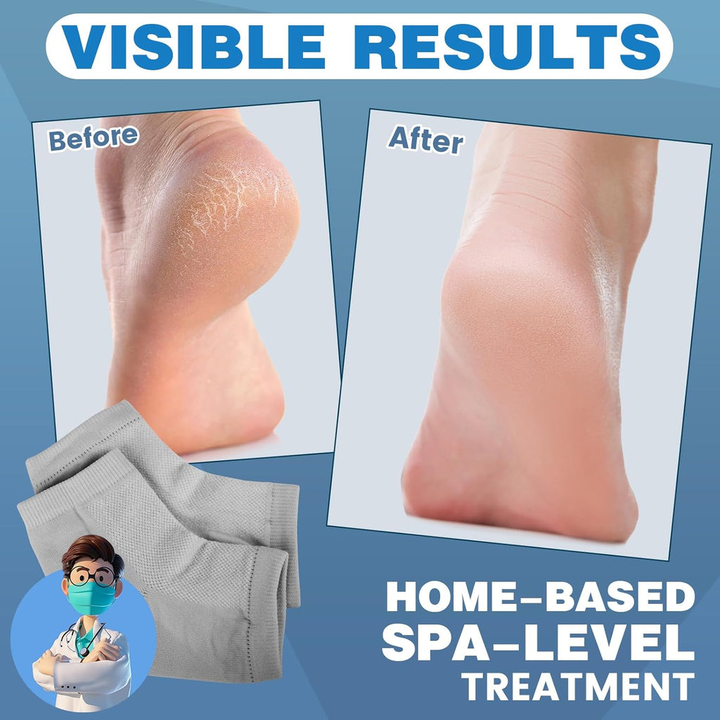 TEAWOO Moisturizing Heel Socks - 6 Pairs for Dry Cracked Feet | Toeless Gel Socks for Hydration and Repair, Soften and Hydrate Dry Cracked Feet Heels, Gel Socks for Dry Cracked Feet